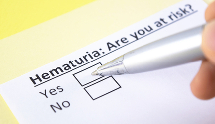 דם בשתן - תמונת המחשה